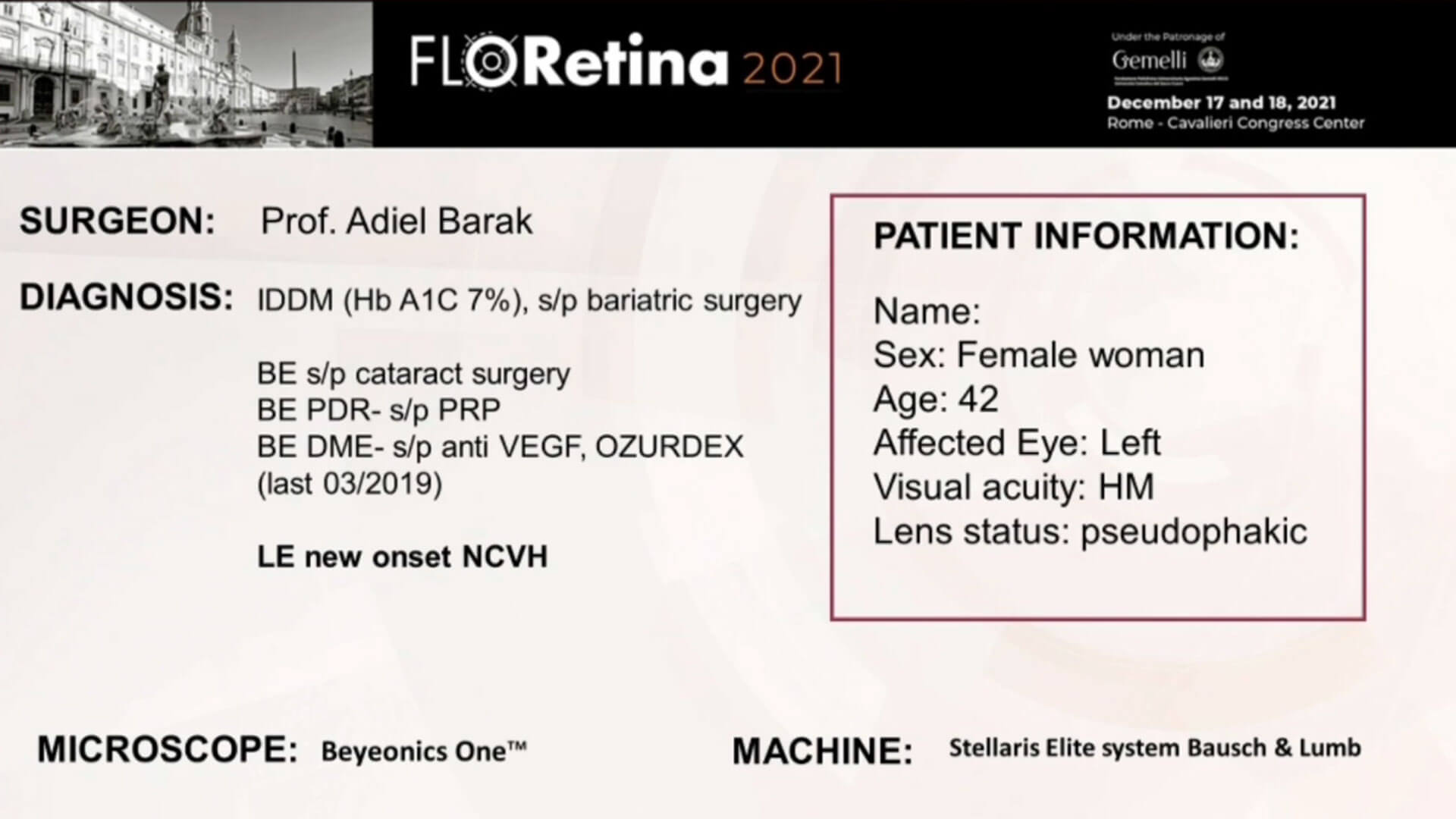 Diabetic Retinopathy